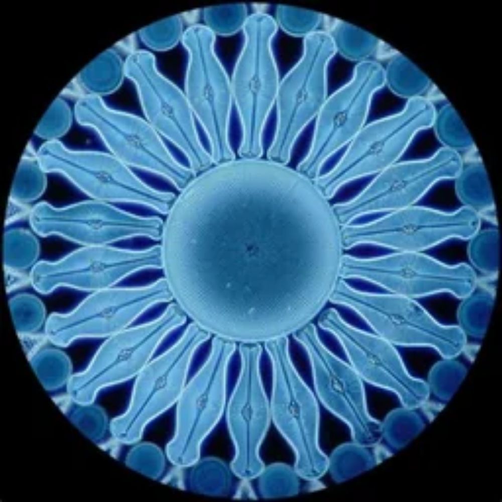 DazzlingDiatom
