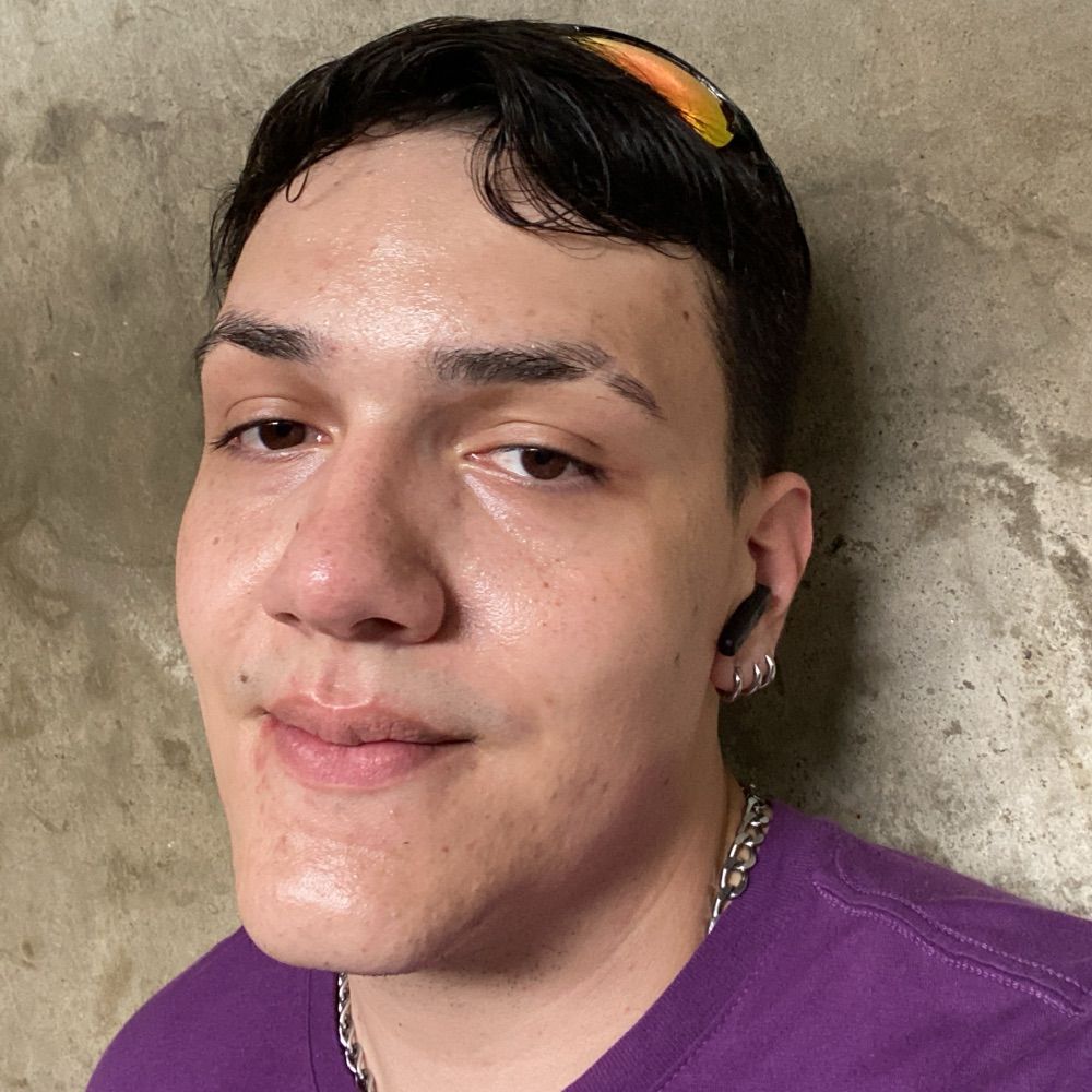 Hipotallamo