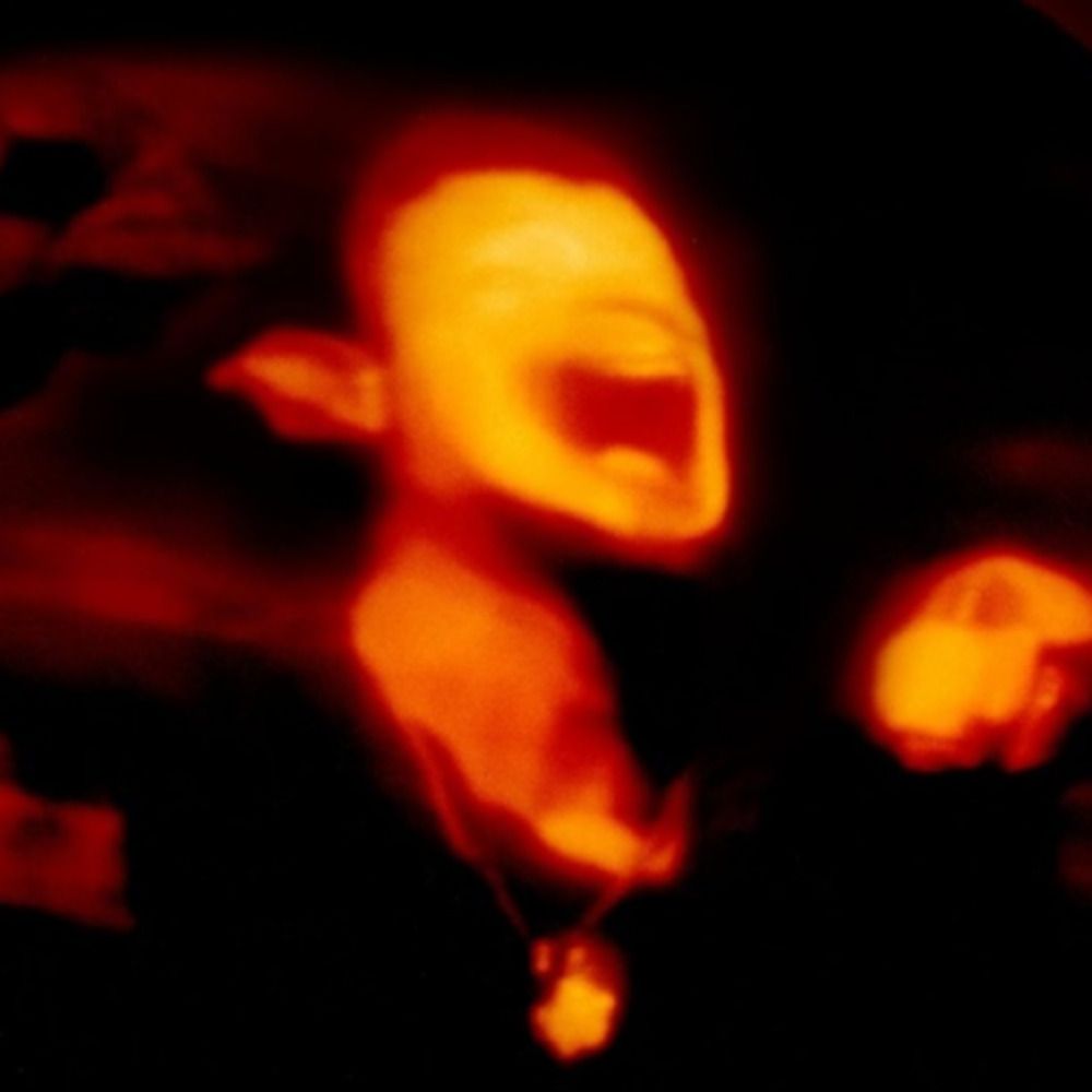 nitronick