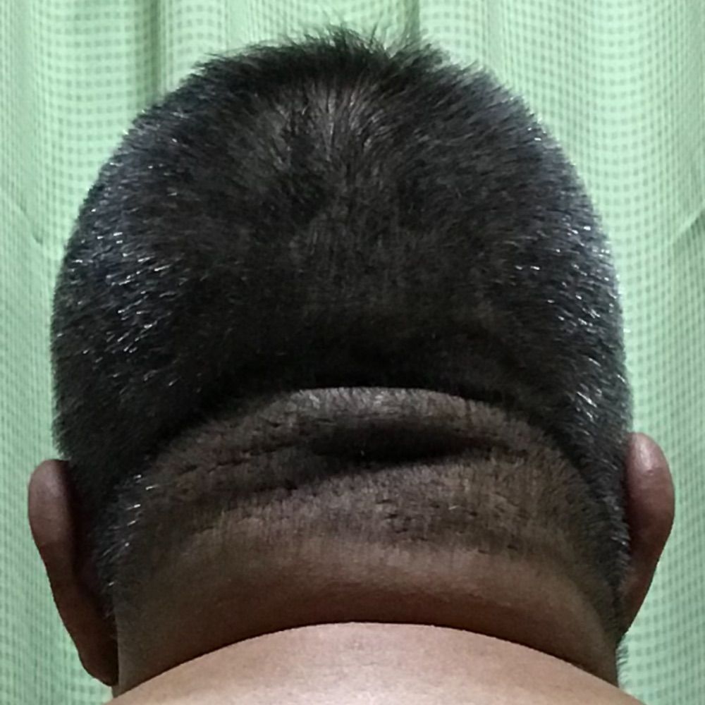 正樹