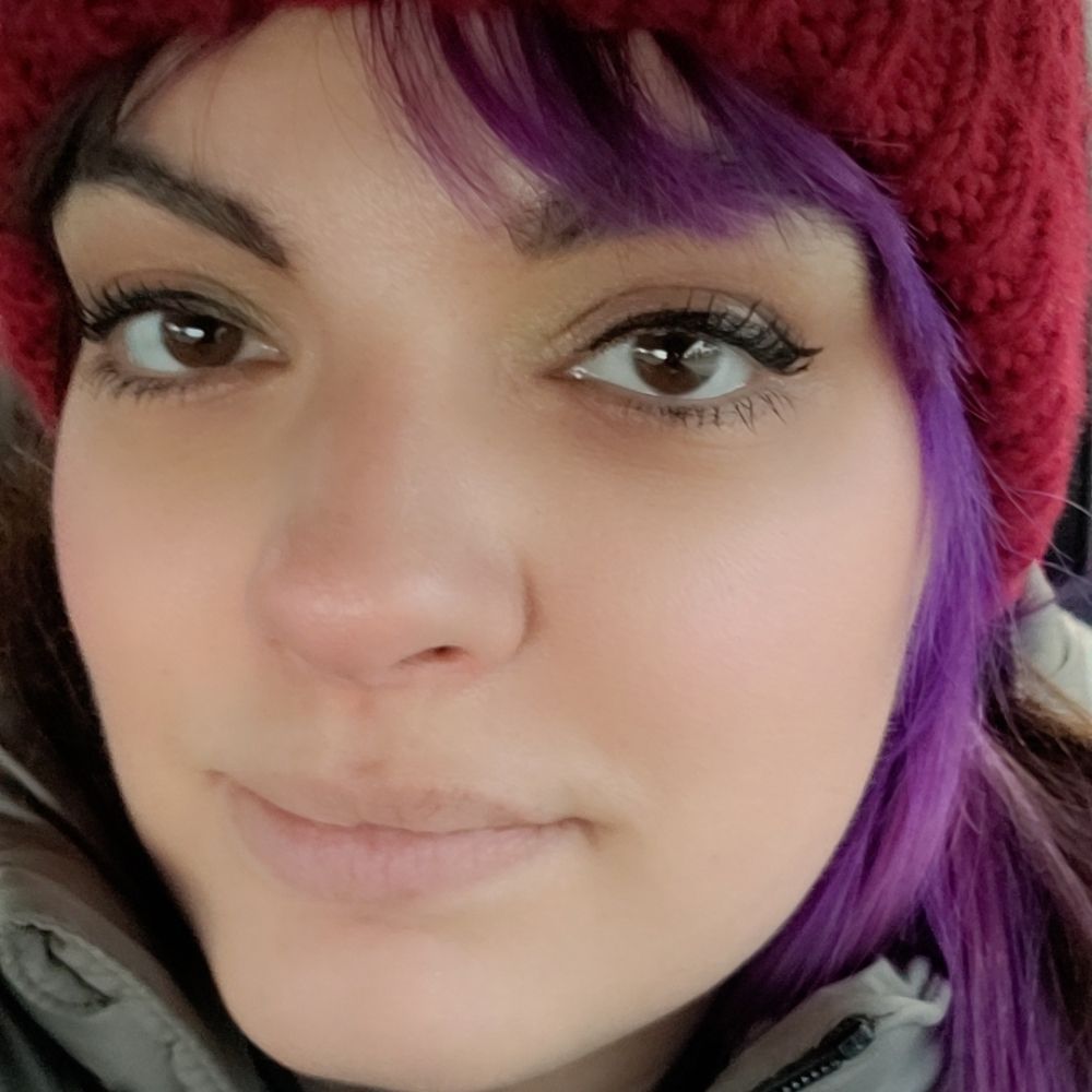 Allison Dicks