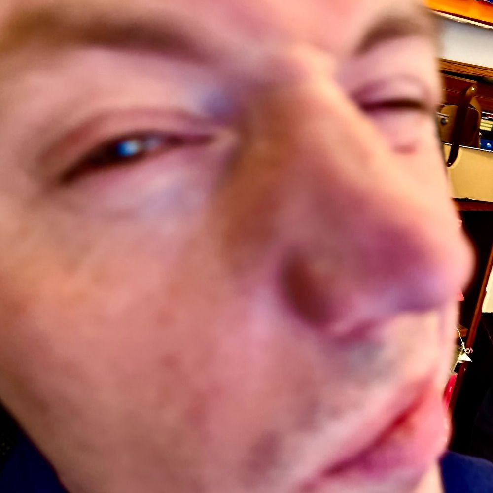 Böna B