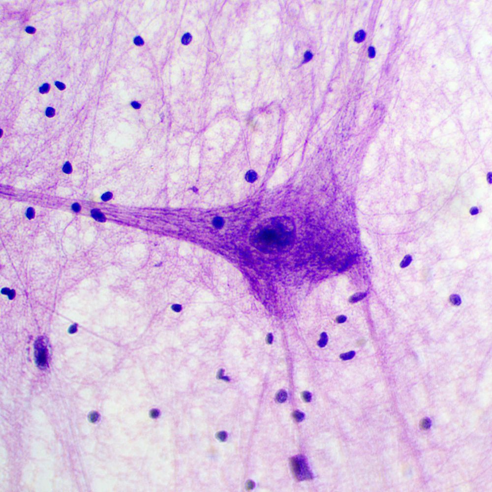Olecranon