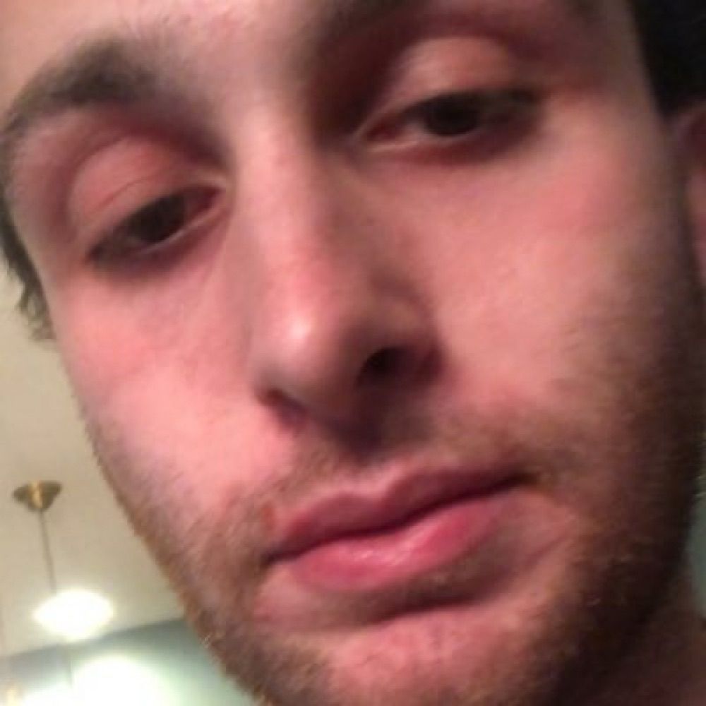Matt Alfano