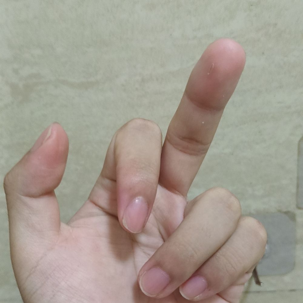 憨小北