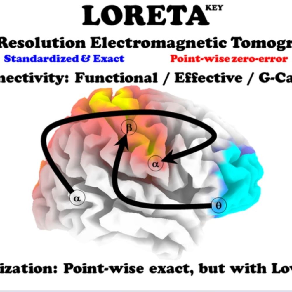 LORETA-KEY toolbox