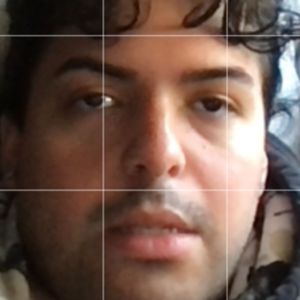 7excess_