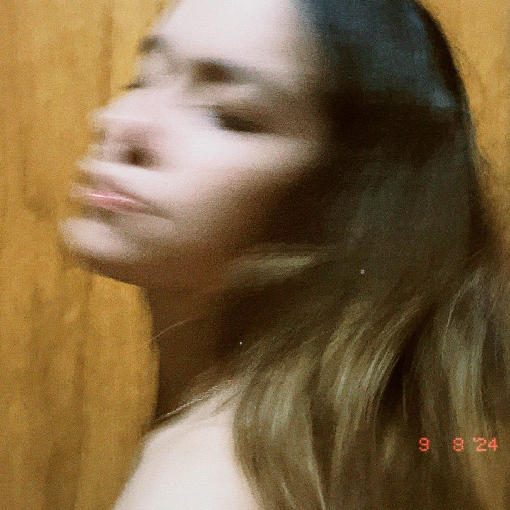 ex vesga 