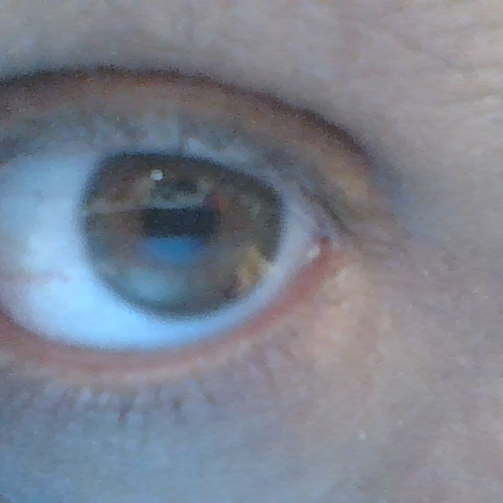 Adam Strier MD
