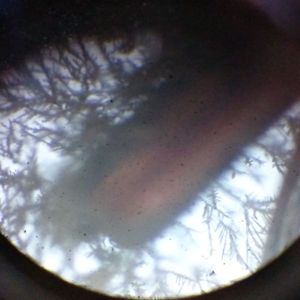 てくね(Tc2、Technetium)