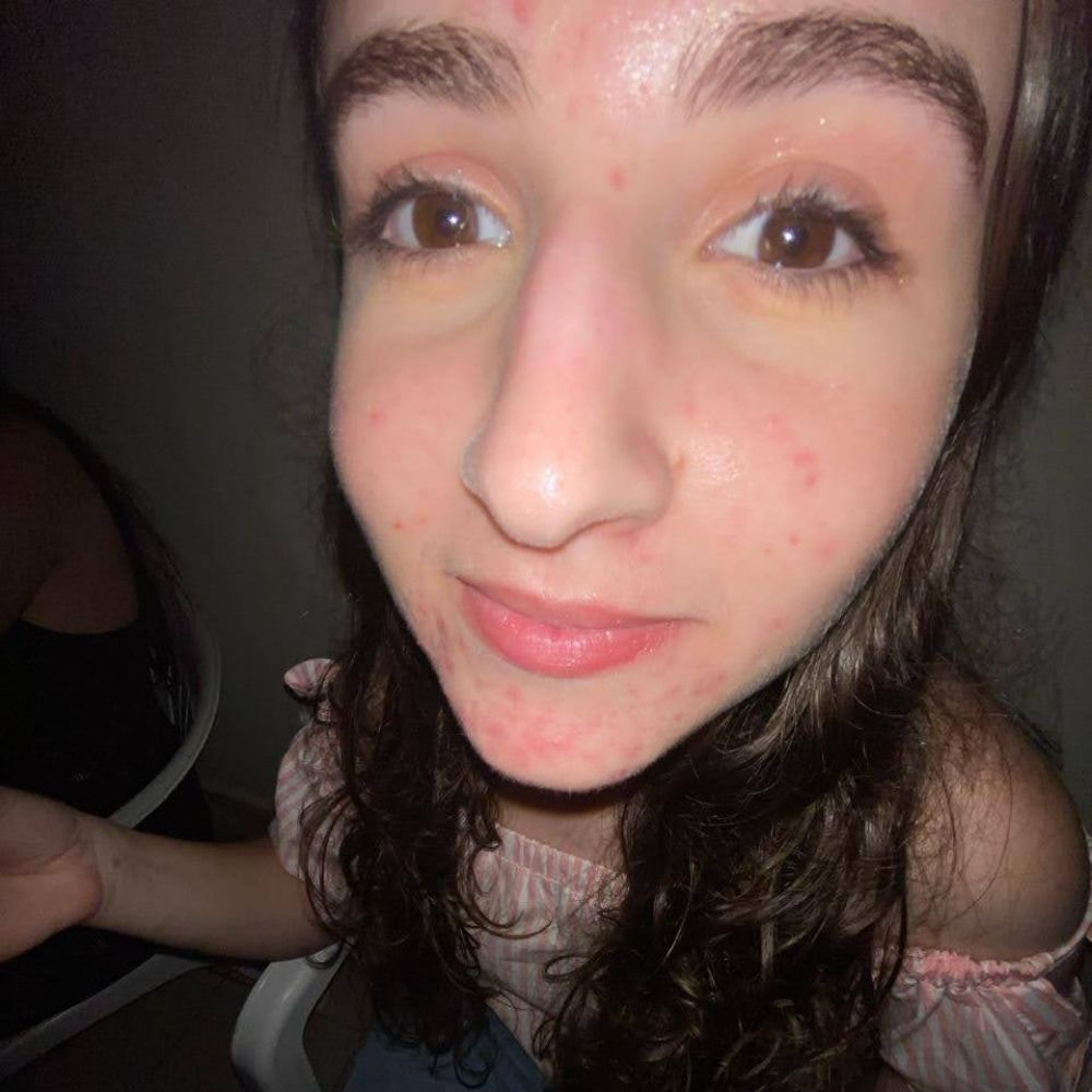 Nat