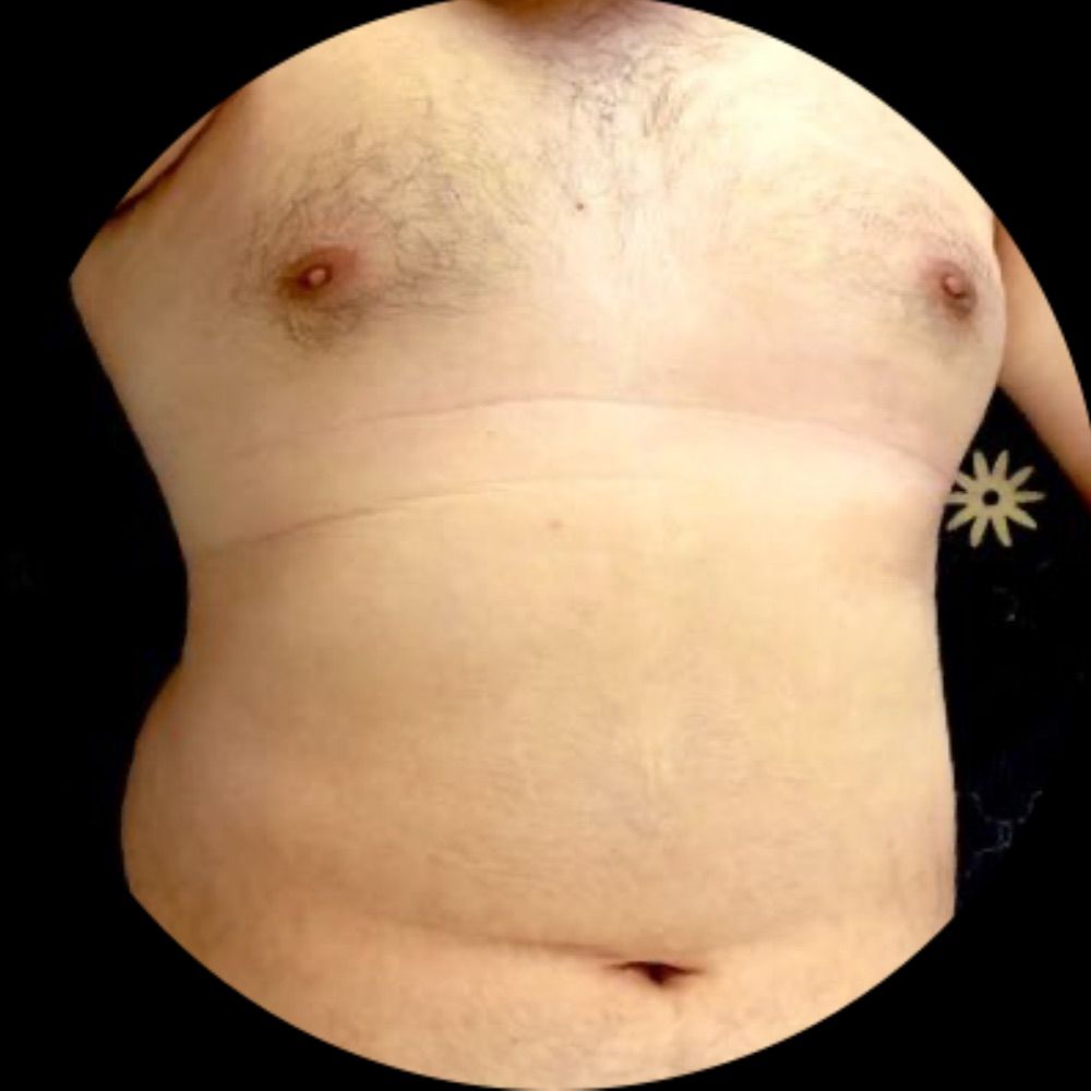 WZ