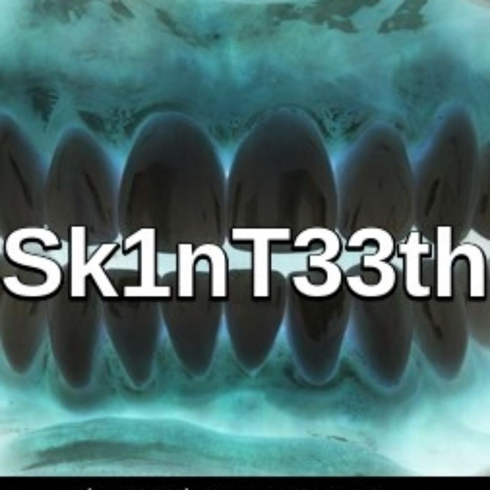 Sk1nT33th