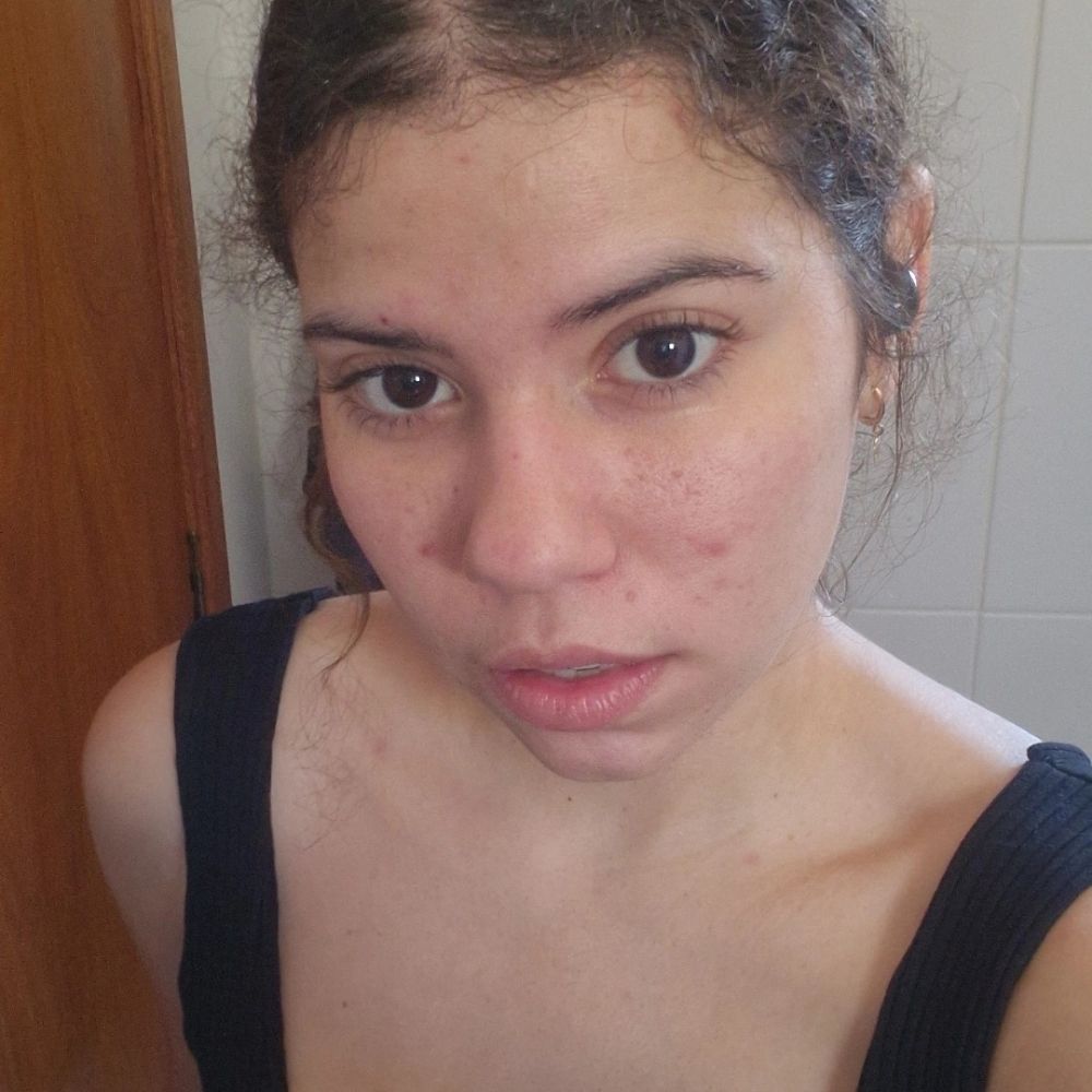 Lígia