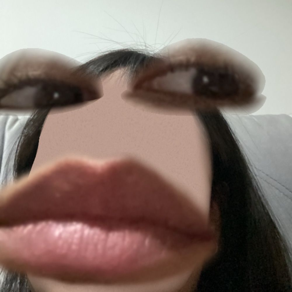 Arachelcp 
