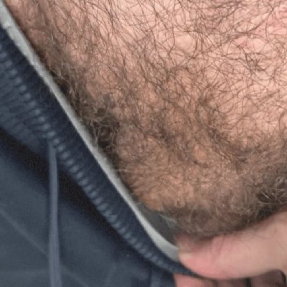 Hairylad2022