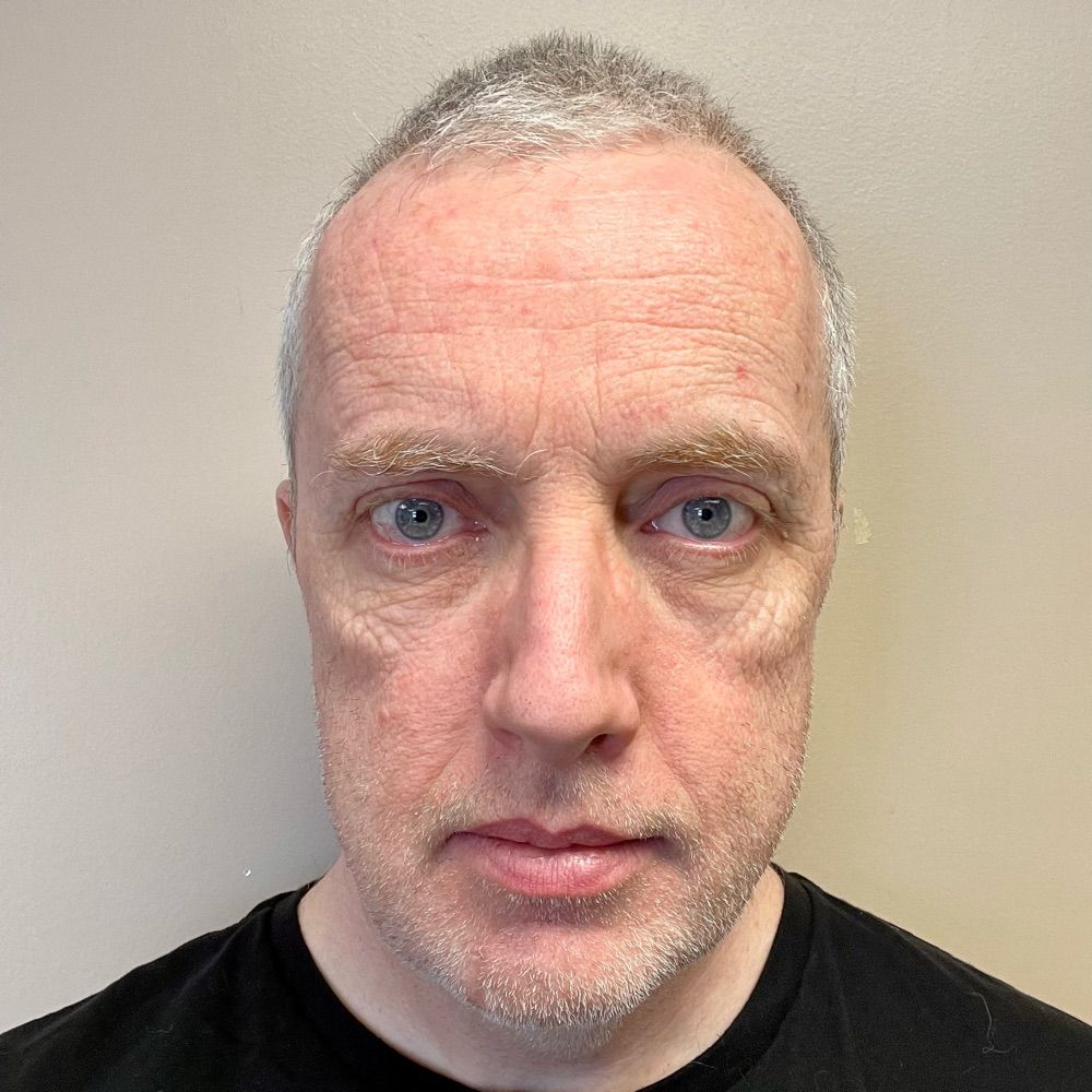 Steve D’Arcy