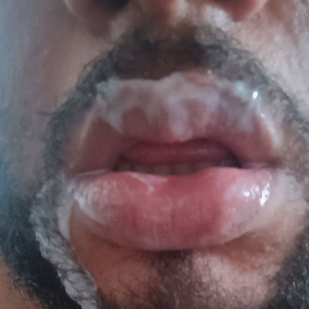 Passivo da ZN/RJ