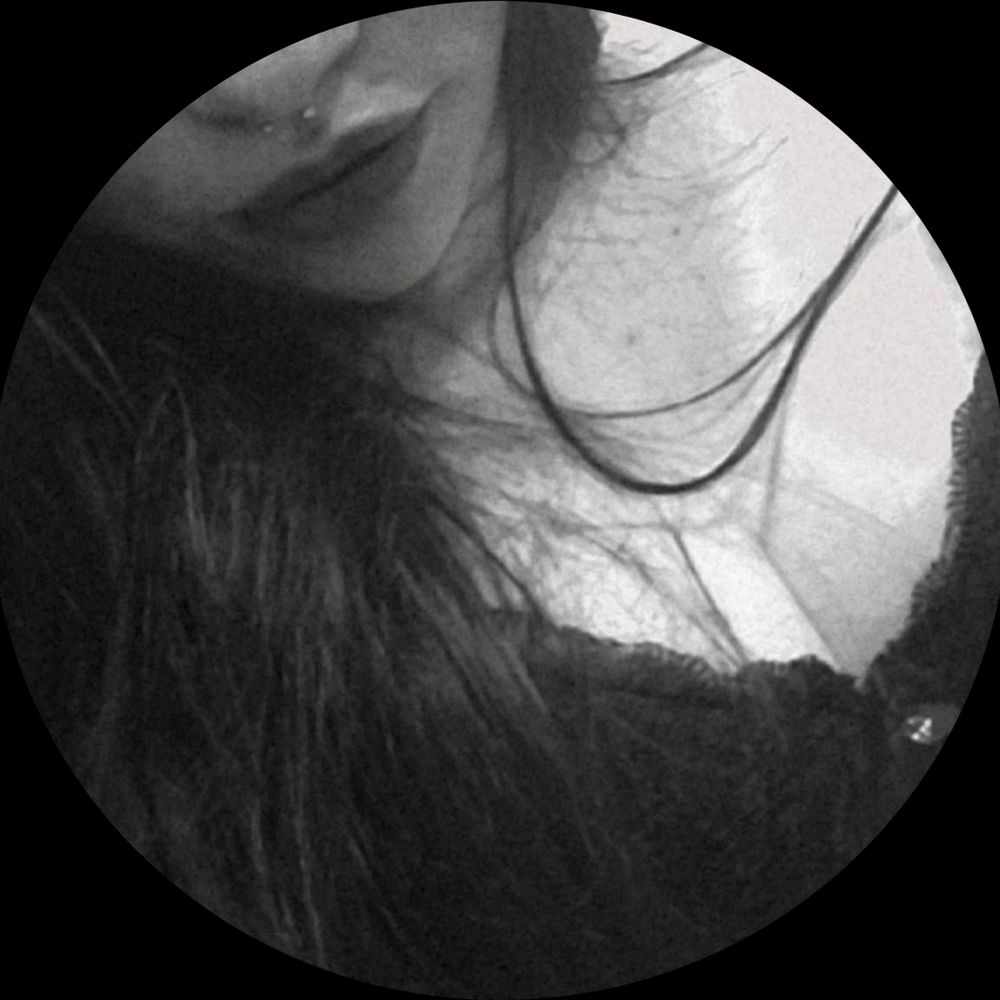 nati