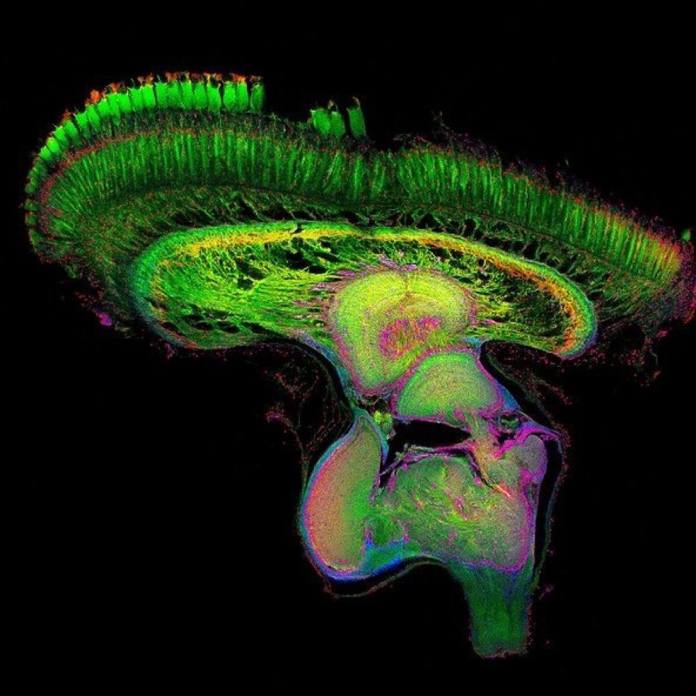 The Hassan Brain Development Lab