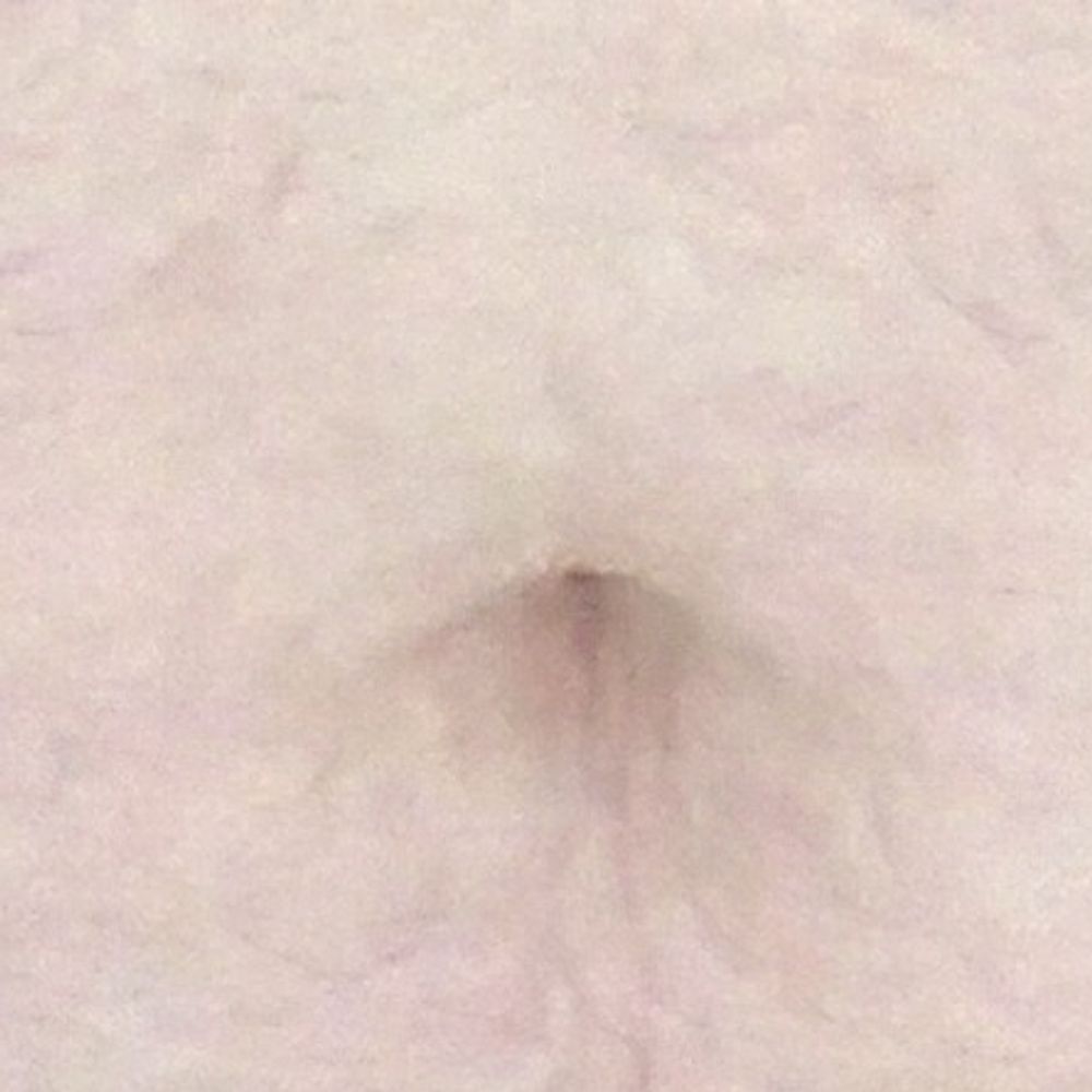 Acesbellypet
