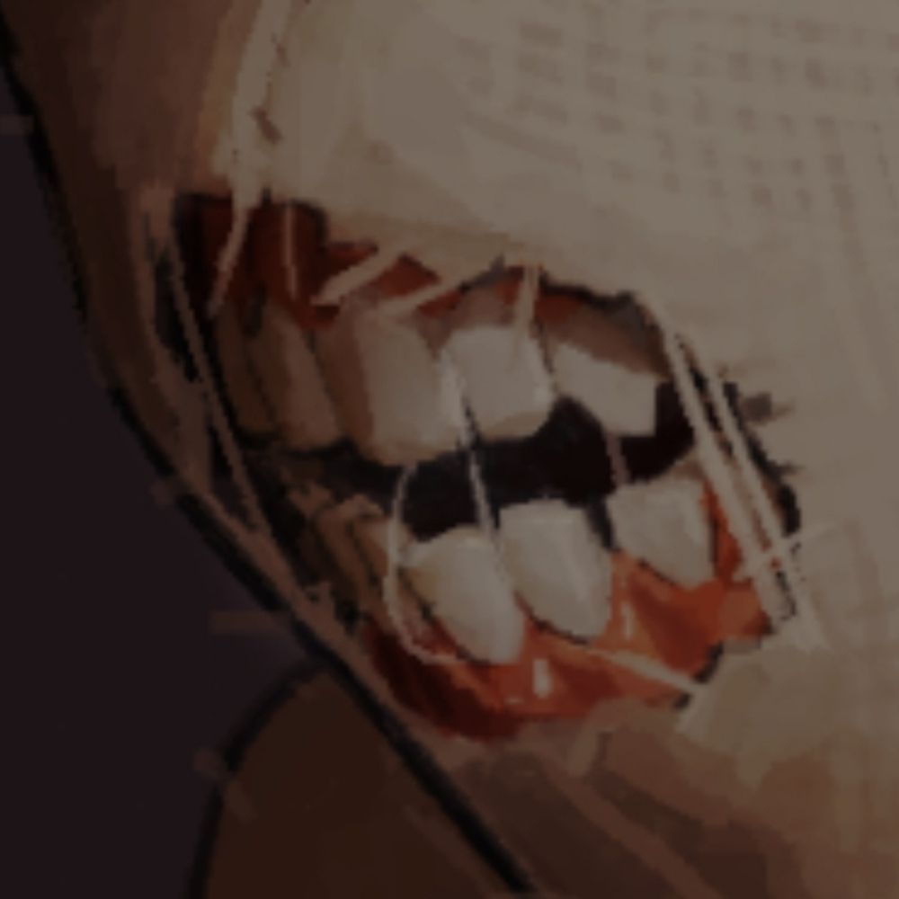 CHOBBE