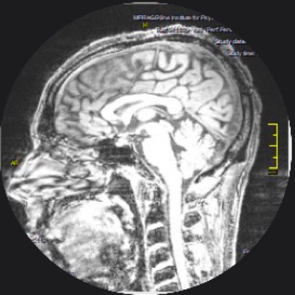 Neuroscience! All Day, Everyday!