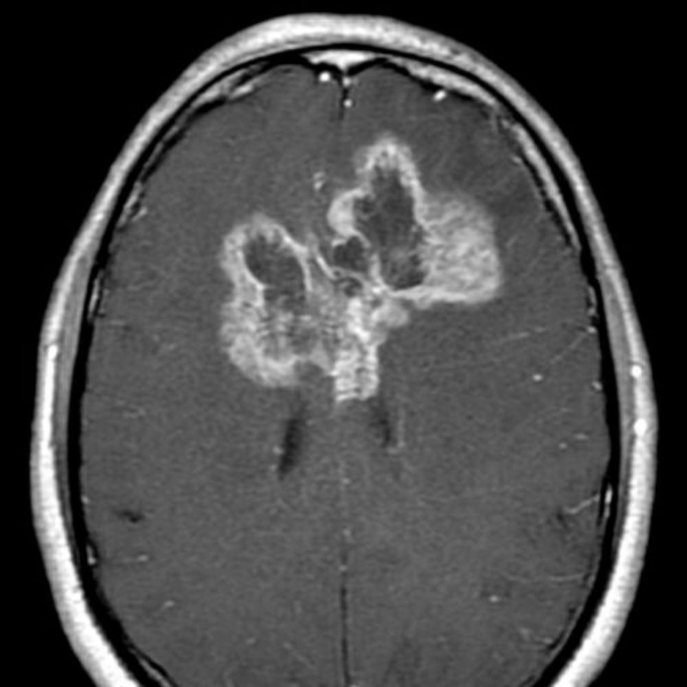 Ex-Clinical Oncology Reg