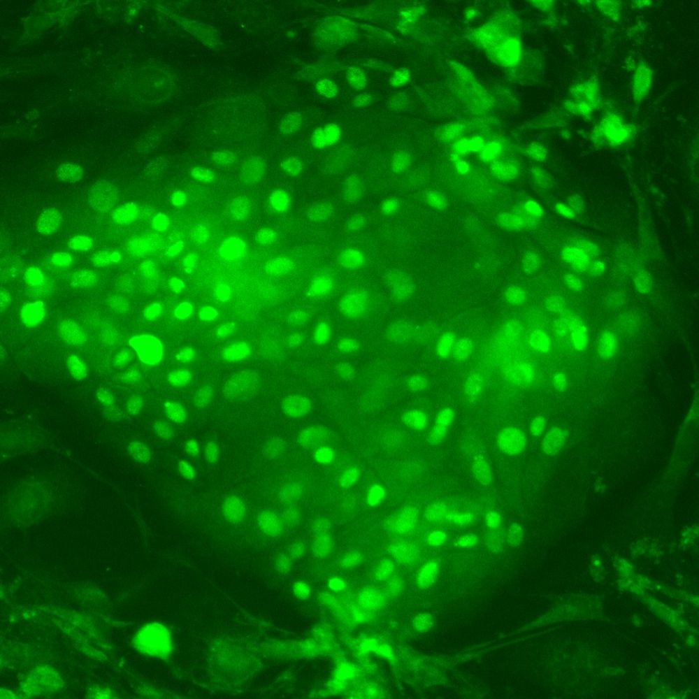Barts Centre for Squamous Cancer