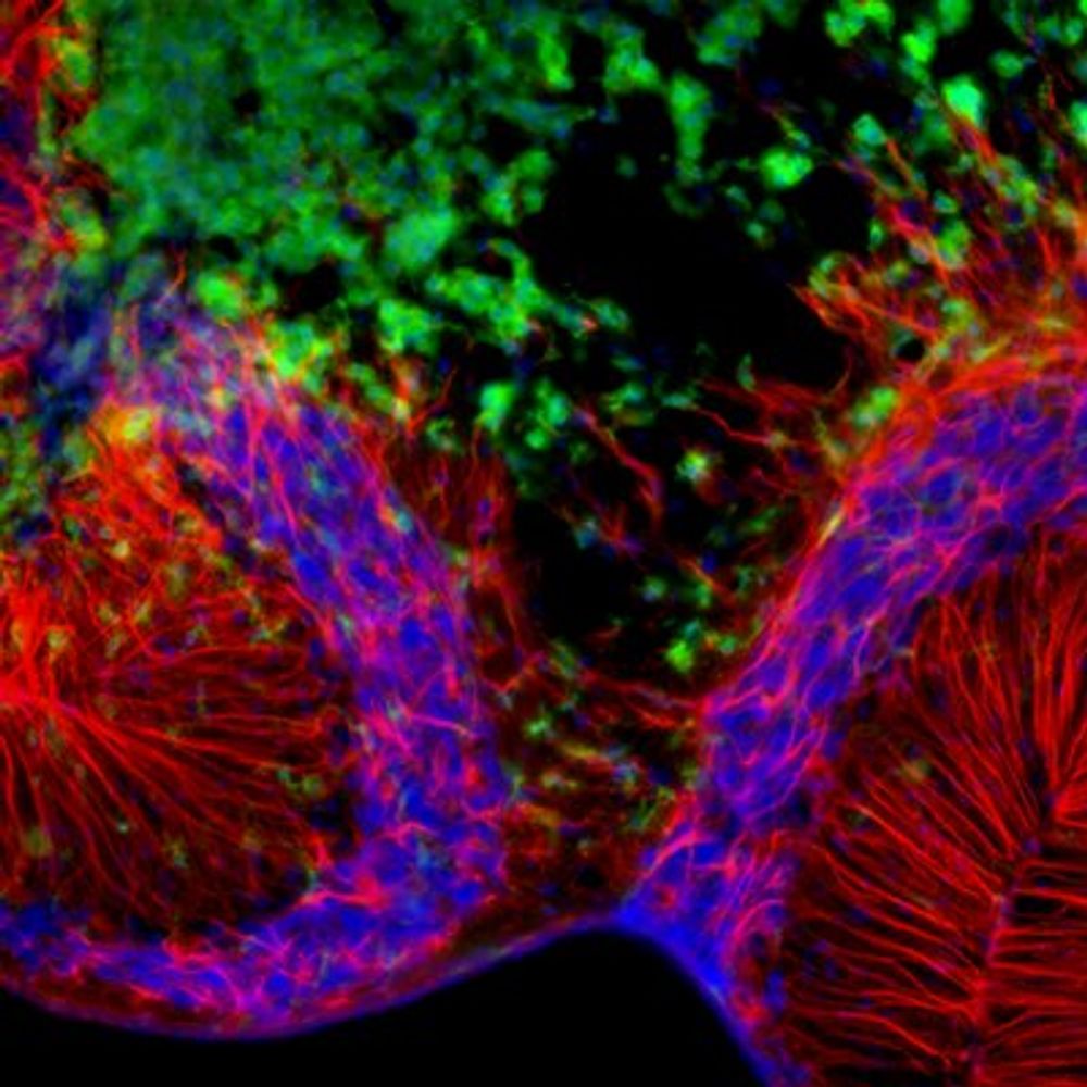 Mitochondrial Neuropathology