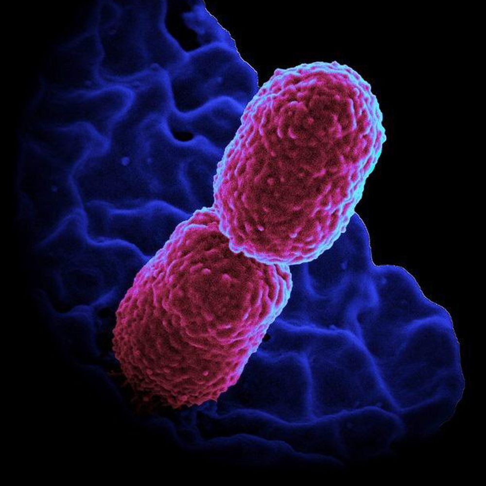 Klebsiella Papers