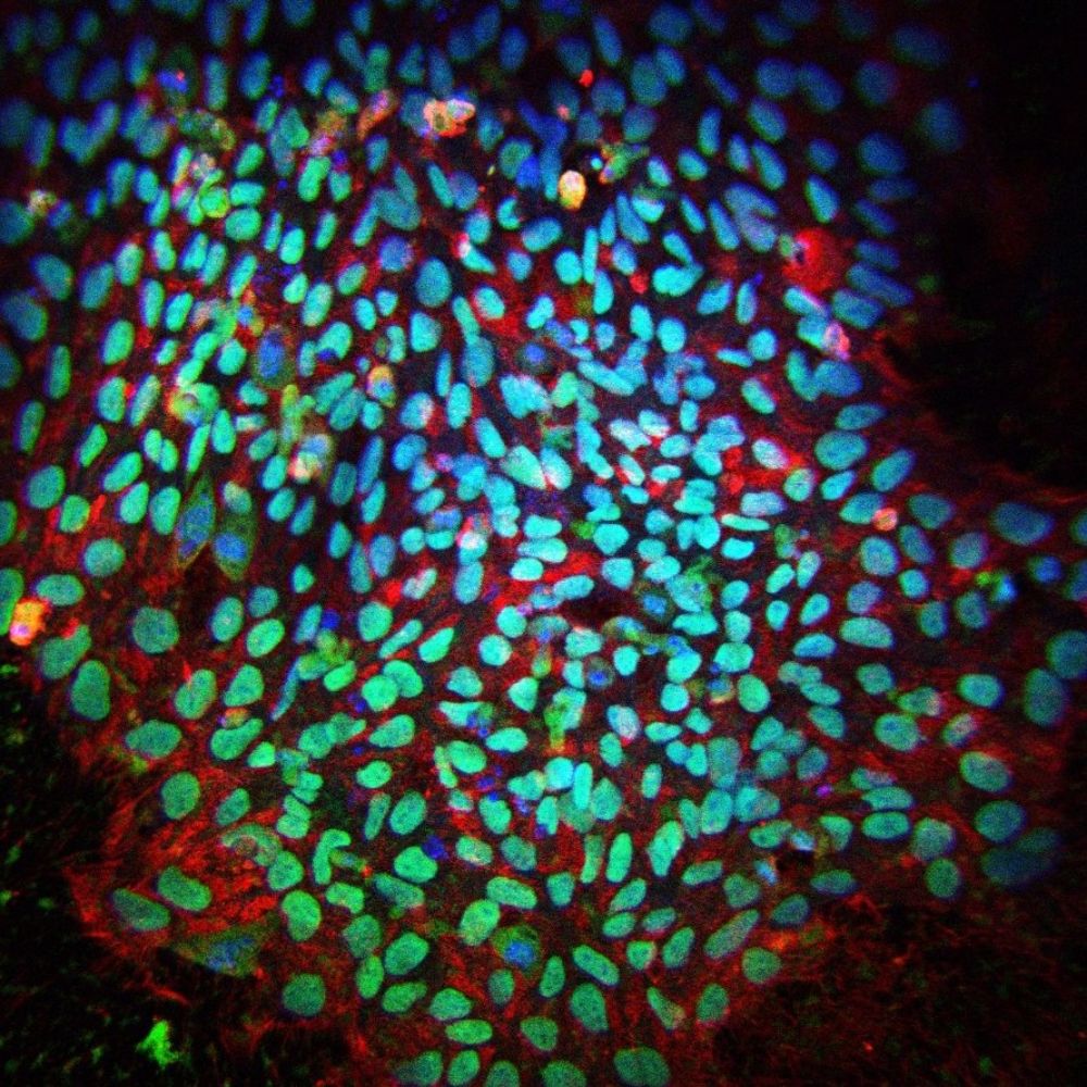 Tajbakhsh Lab
