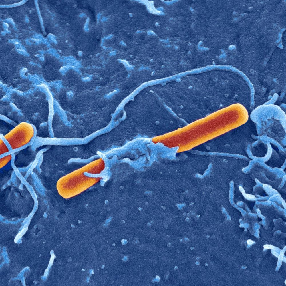 The Shigella Meeting