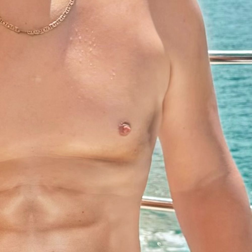 James