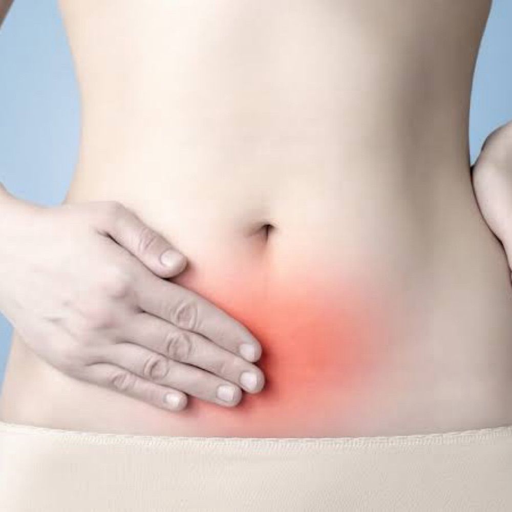 Pelvic Pain NZ
