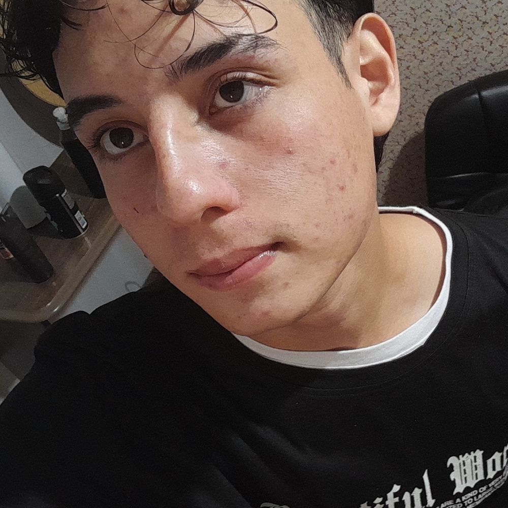 Erick