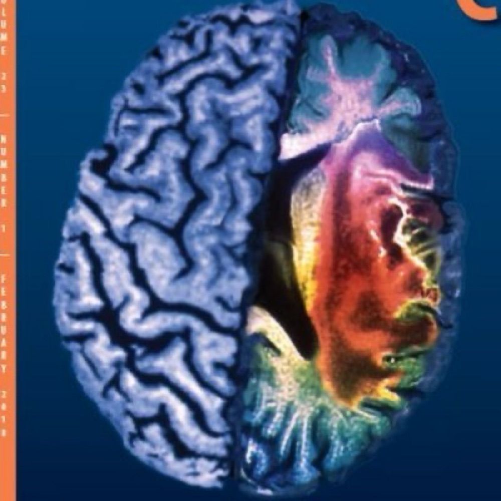 Neurocritical Care