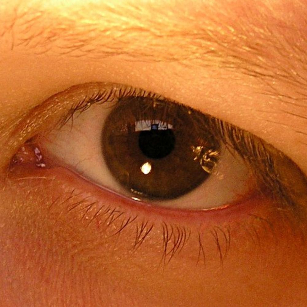 Atara