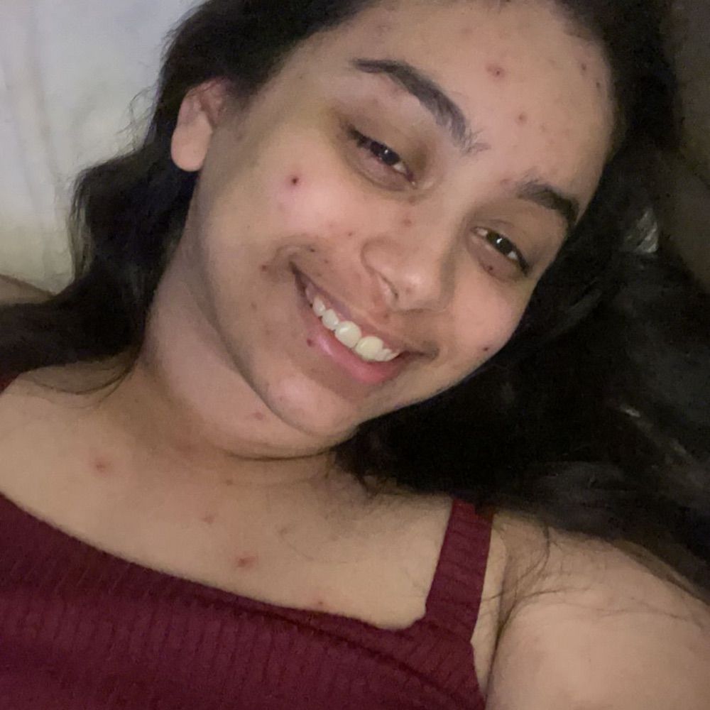 Anandinha 