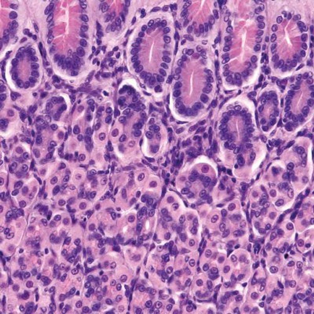 Therapeutic Advances in Gastroenterology