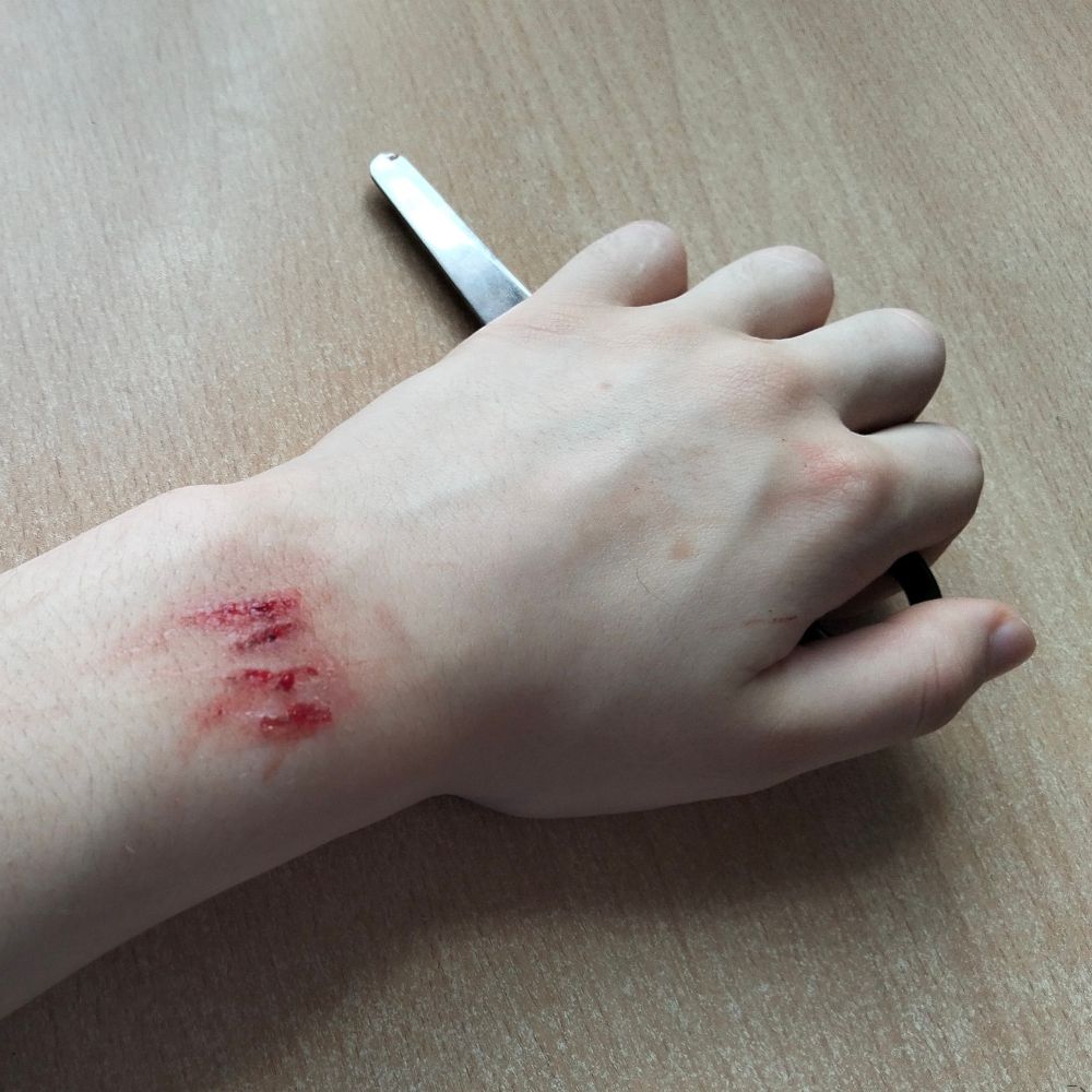 Paperskin