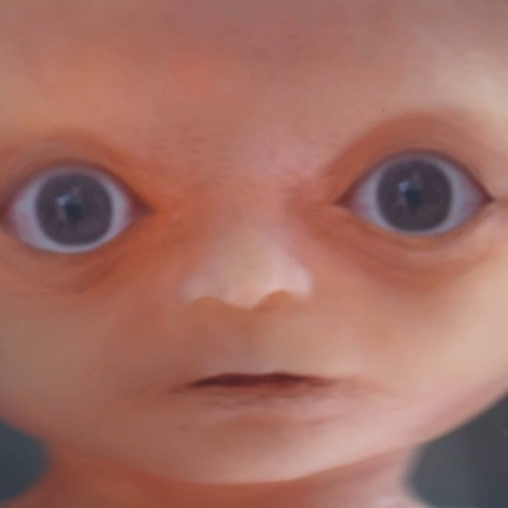 time travel foetus teratoma
