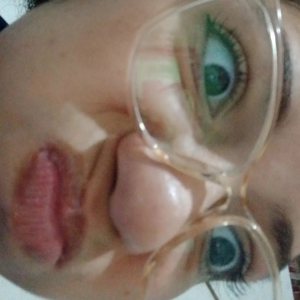 Clarão