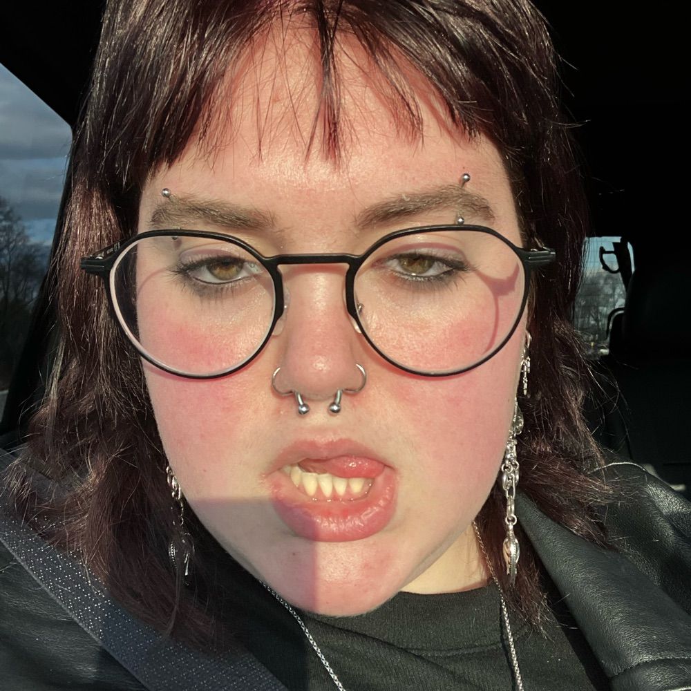 🦨fern agostino🦨
