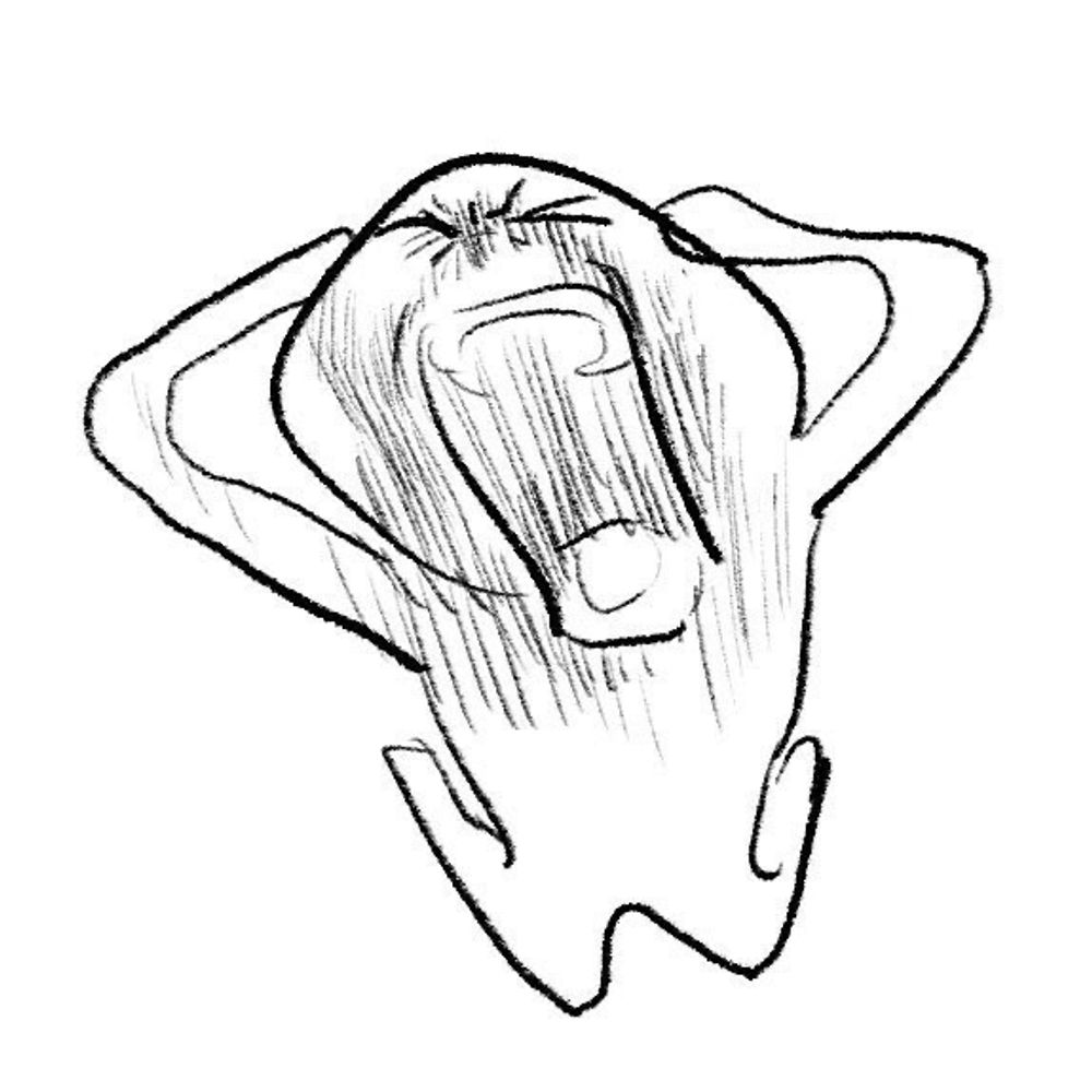미새