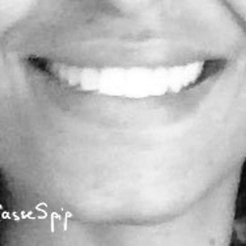 CasseSpip