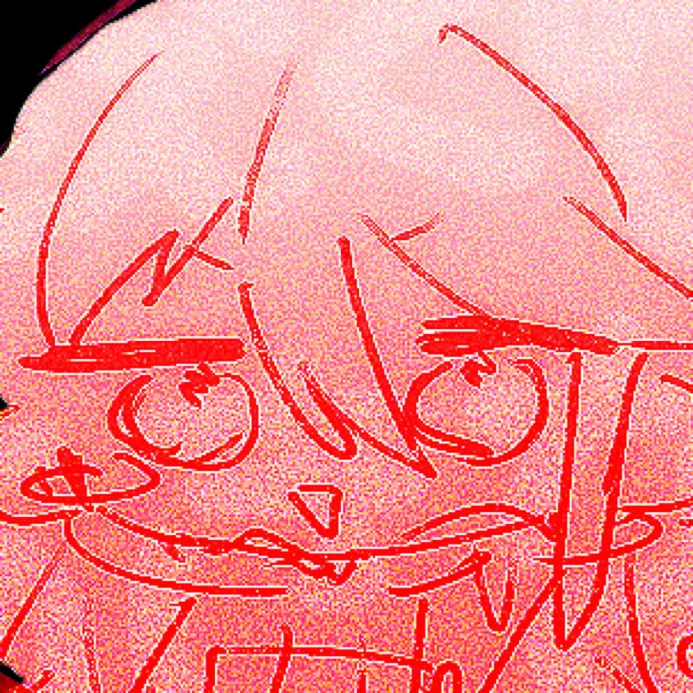 しもやけ