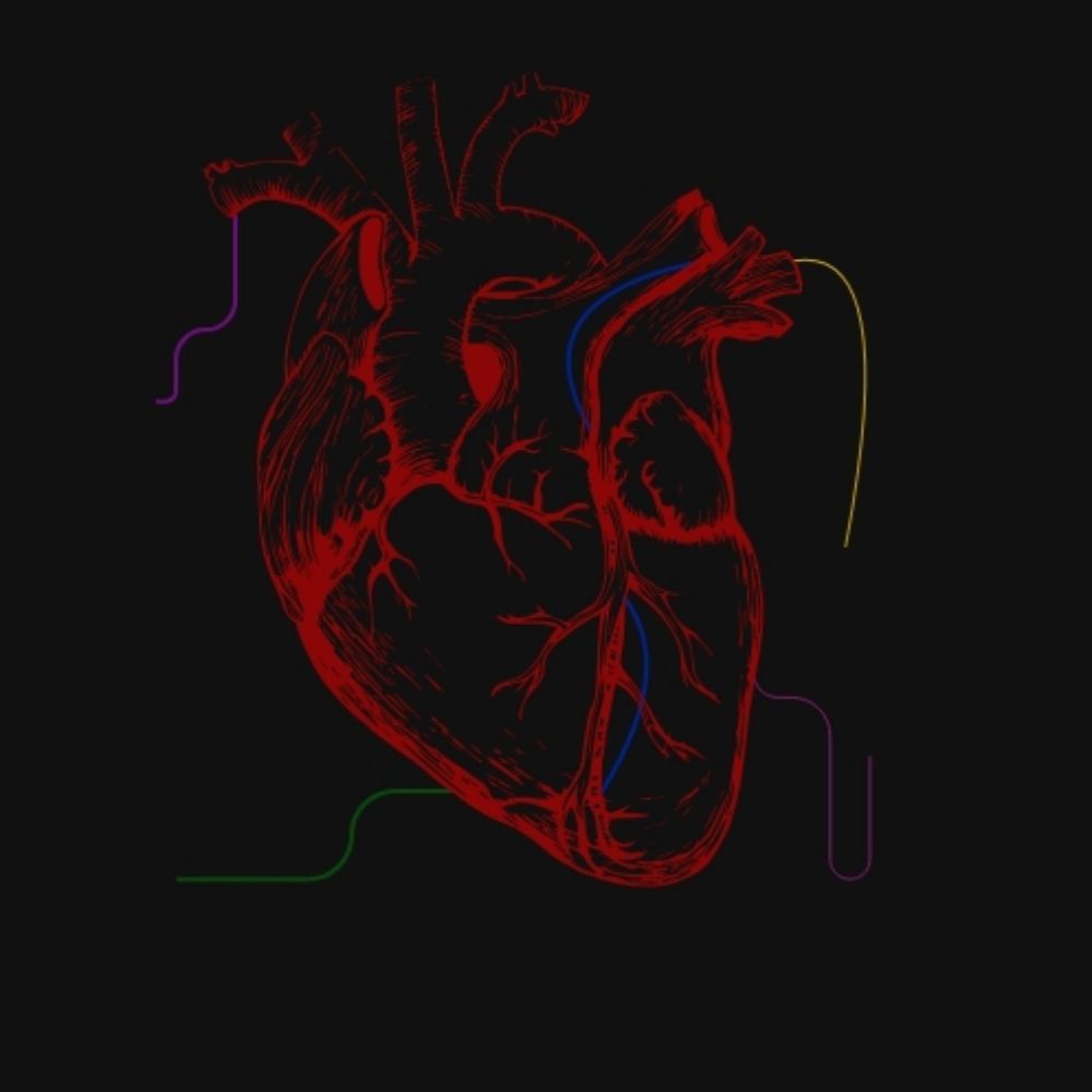 Arrhythmia