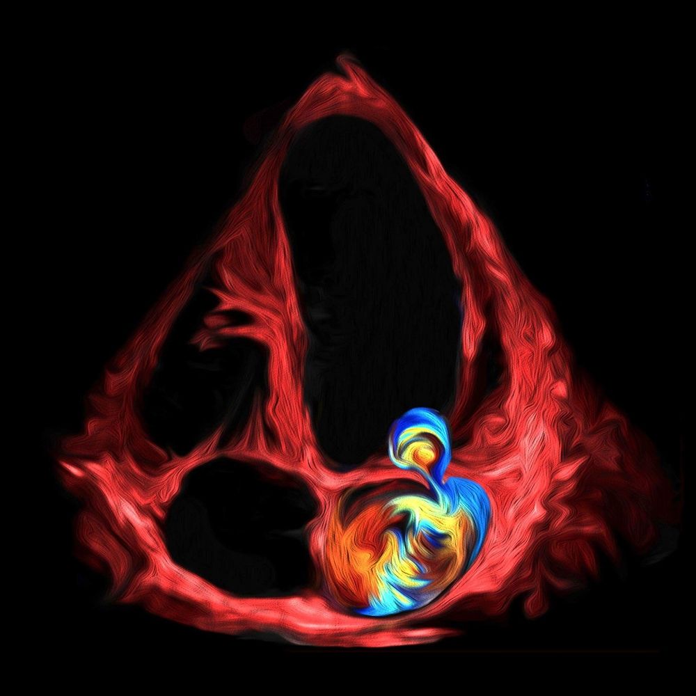 EchoArt