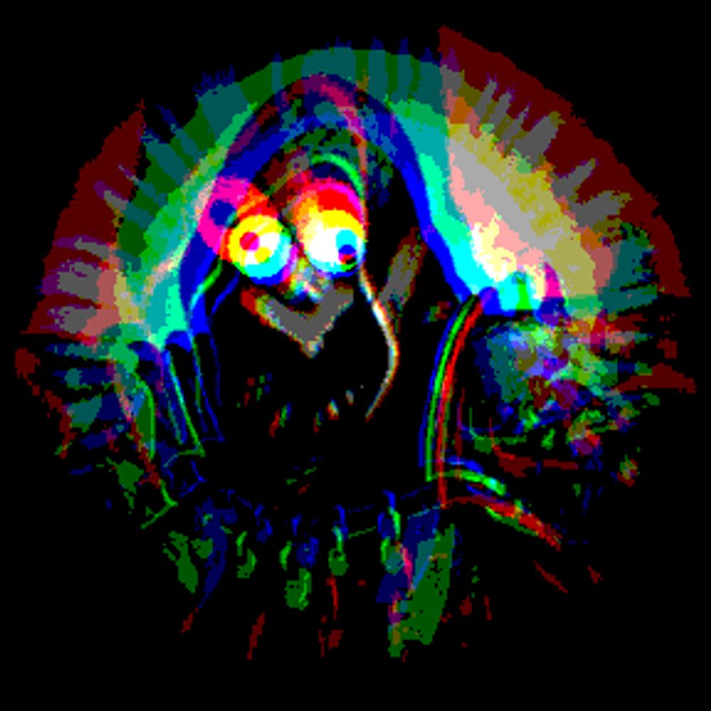 Shador